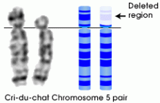 cri-du-chat_diagram.gif