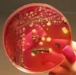 Salmonella growing on XLD agar.jpg
