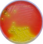 Salmonella growing on XLD agar 2.jpg