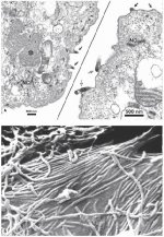 Transmission (A) and scanning.JPG